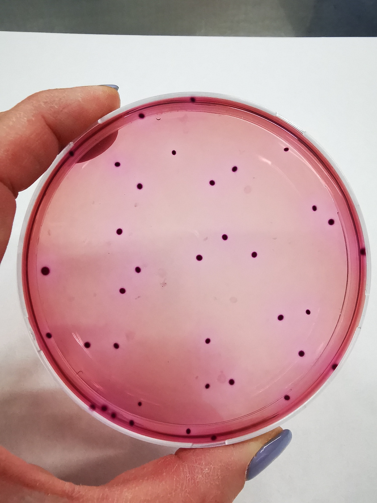 Analisi degli enterobatteri in laboratorio