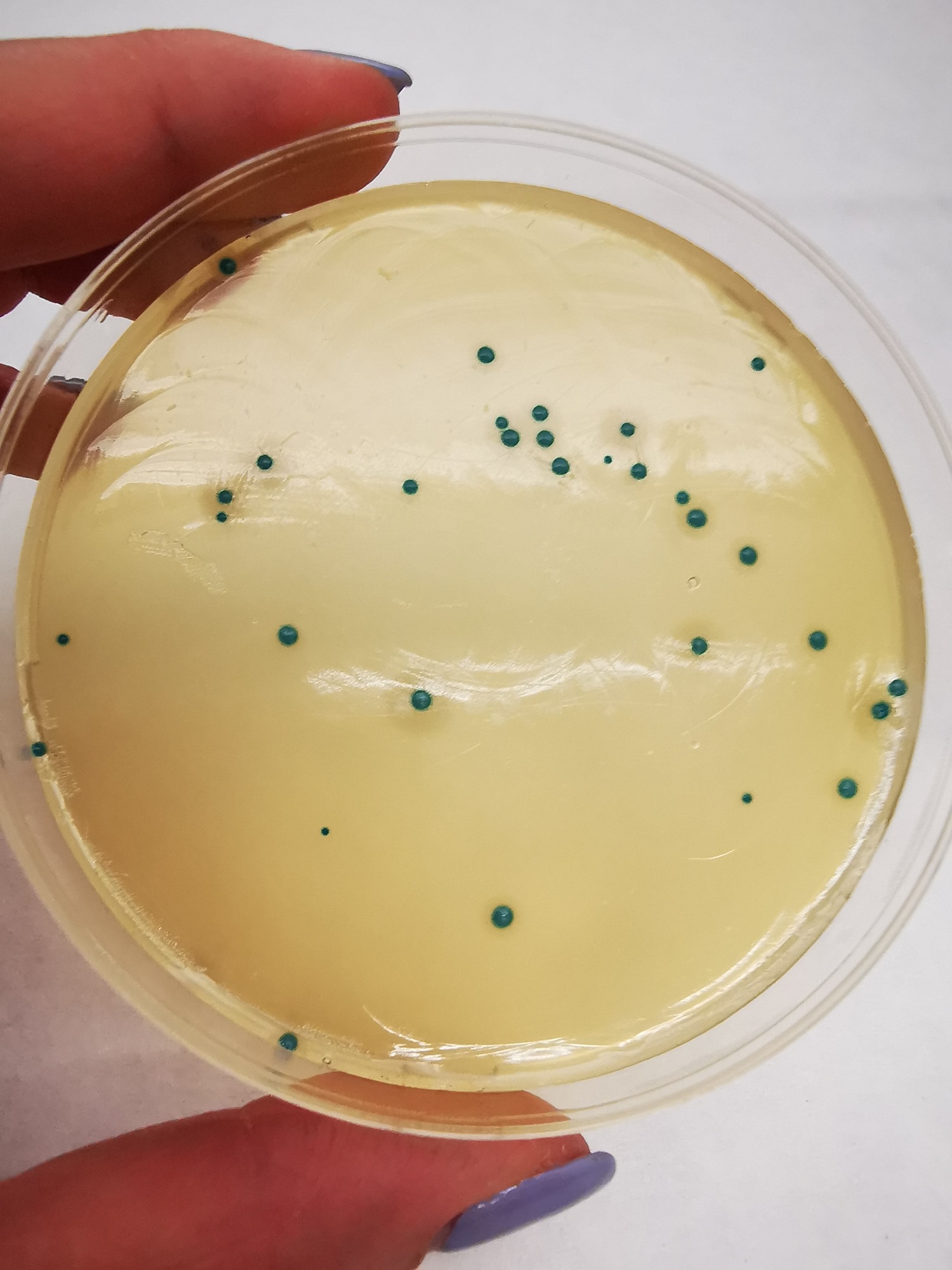 Analisi di laboratorio della Listeria