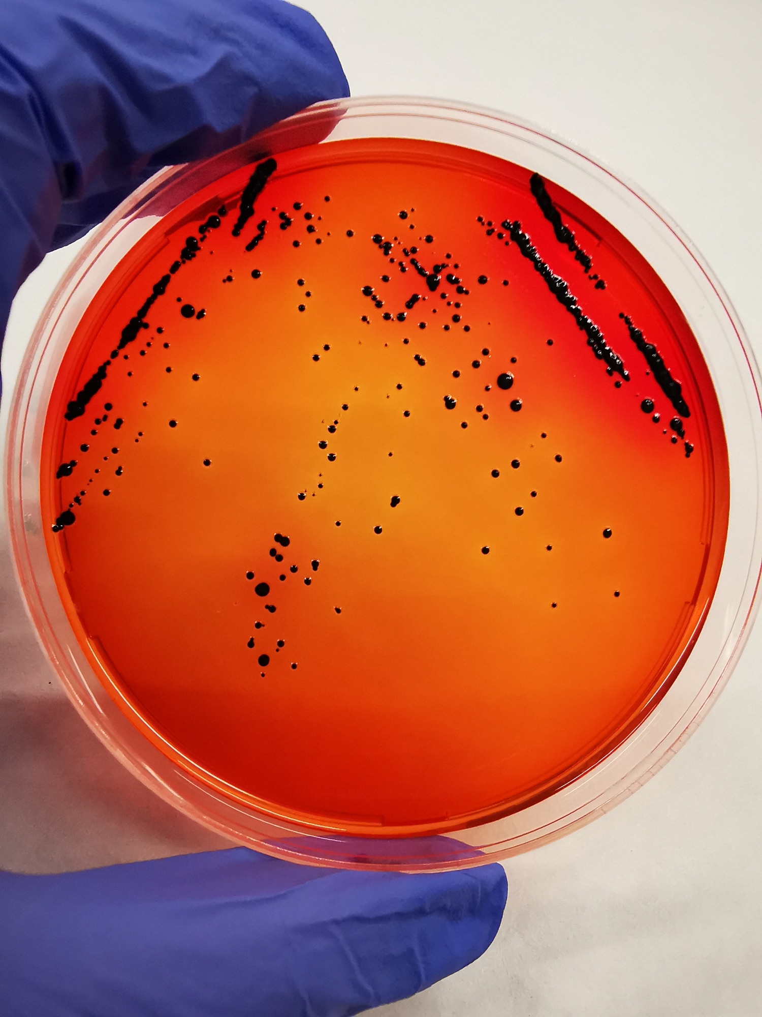 Analisi di laboratorio della Salmonella